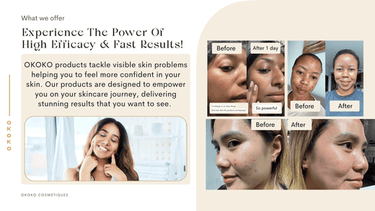 A Day in the Life of an Eco-Conscious Skincare Enthusiast: Featuring O ...